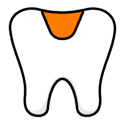 Simple tooth extraction